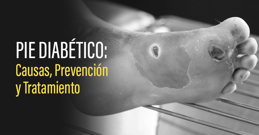 Pie diabético. Causas, prevención y tratamiento.